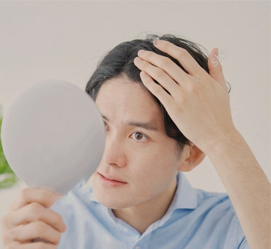 薄毛
